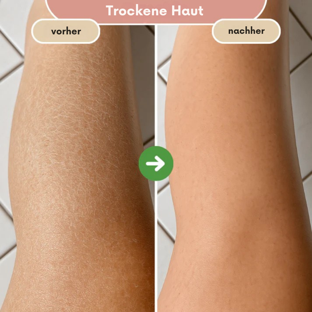 ShinyBrush – die Bürste für trockene Haut