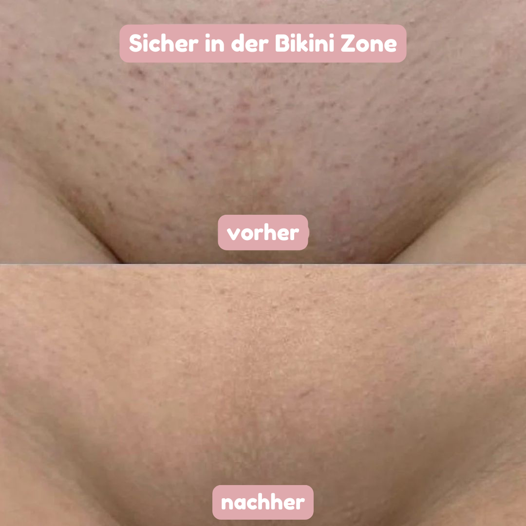 ShinyShave – Das Original 2-in-1 Rasierer & Trimmer