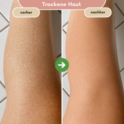 ShinyBrush – die Bürste für trockene Haut