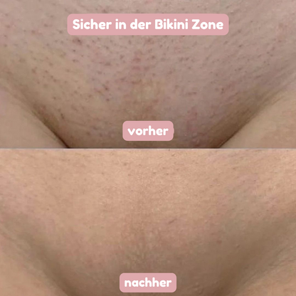ShinyShave – Das Original 2-in-1 Rasierer & Trimmer